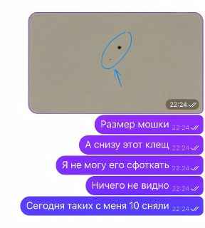 Опасные микроклещи: как защититься от инфекций в России