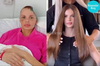 Восстановление модели: новая жизнь Анжелики Тартановой после травмы